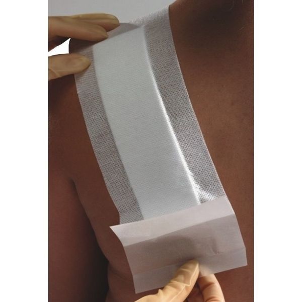 Primapore And Melolin Adhesive Dressing 10x25cm