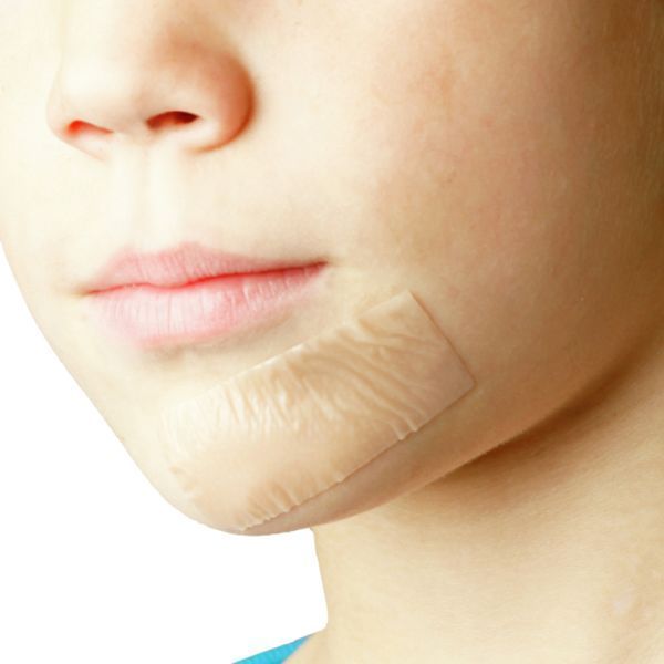 Askina Scar Repair 10cm x 18cm Box 5 - Image 2