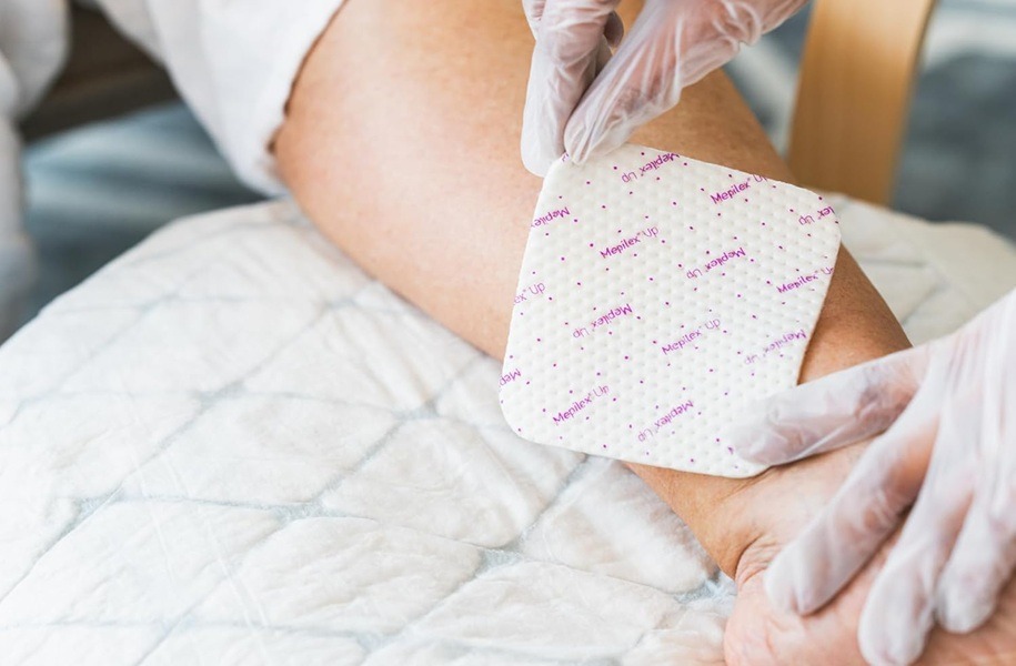 Mepilex Up 20cm x 20cm Soft Silicone Foam Dressing Sterile Box 5 - Image 2