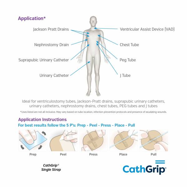 CathGrip Original Single Strap Small Non-Sterile - Image 3