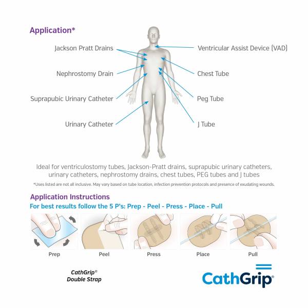 CathGrip Original Double Strap Large Non-Sterile with BioPlus Wipes - Image 3