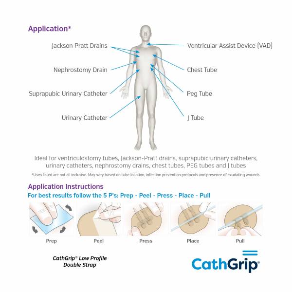 CathGrip Low Profile Double Strap Large Non-Sterile with BioPlus Wipes - Image 3