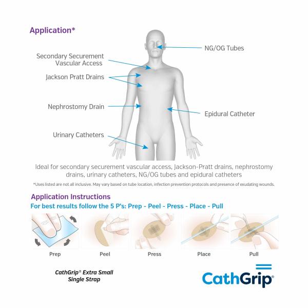 CathGrip Extra Small Non-Sterile - Image 3