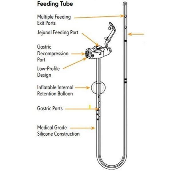 Image of a feeding tube